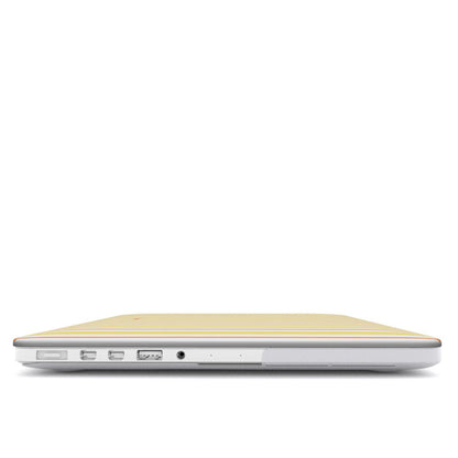 Vertical Flow - Yellow & Orange - MacBook Case