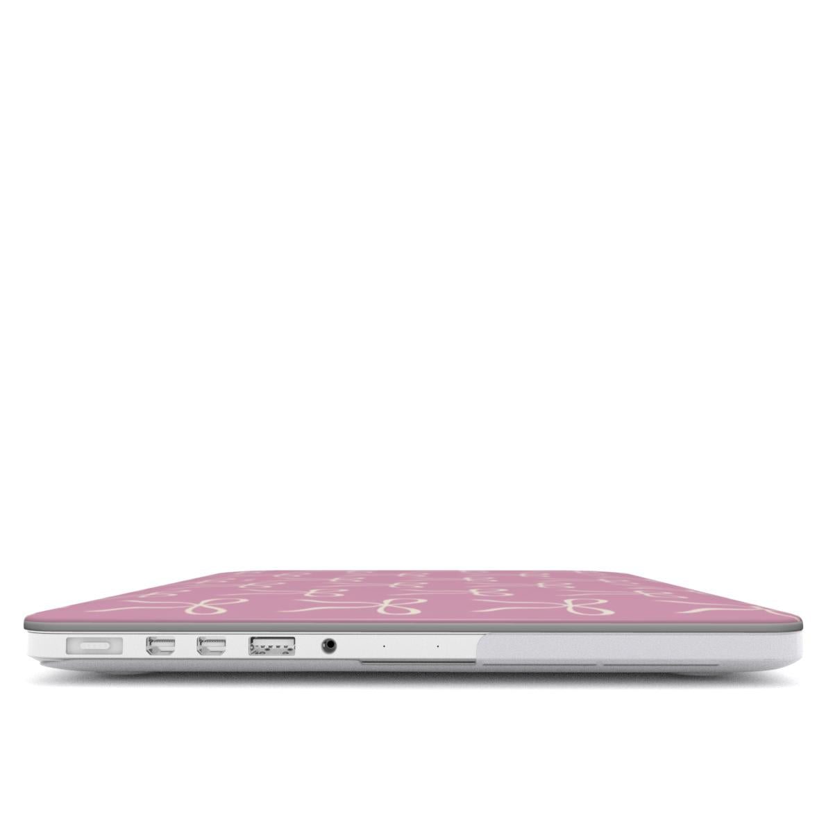 Bow Charm - Rosa - Capa para Macbook