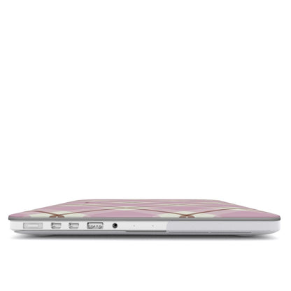 Check Charm - Rosa - Capa para MacBook