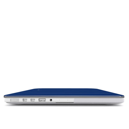 Coloré Sweetline Stripes – Blue MacBook Case with vented base and anti-slip feet, stylish macbook case